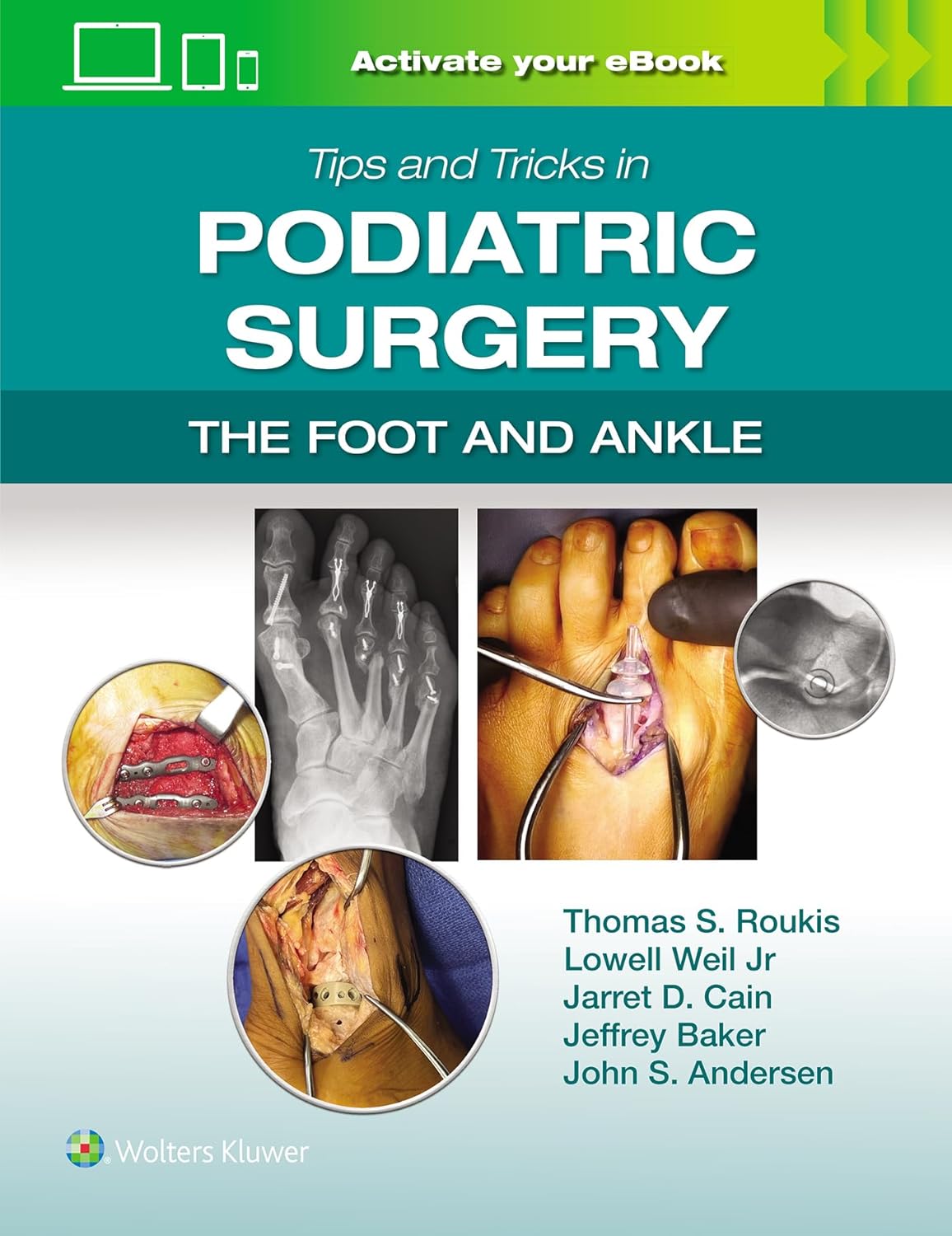Tips and Tricks in Podiatric Surgery: The Foot and Ankle (Videos only) Tips and Tricks in Podiatric Surgery: The Foot and Ankle (Videos only)