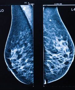 Oakstone UCSF Breast Imaging 2026