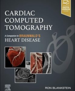 Cardiac Computed Tomography: A Companion to Braunwald’s Heart Disease (PDF)