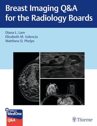 Breast Imaging Q&A for the Radiology Boards (PDF) Breast Imaging Q&A for the Radiology Boards (PDF)