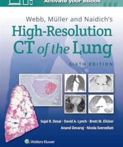 Webb, Müller and Naidich’s High-Resolution CT of the Lung, 6th edition (PDF)