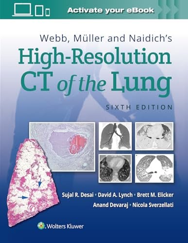 Webb, Müller and Naidich’s High-Resolution CT of the Lung, 6th edition (PDF)