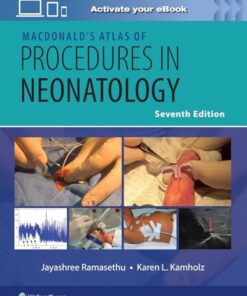 MacDonald’s Atlas of Procedures in Neonatology, 7th edition (EPUB)