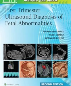 First Trimester Ultrasound Diagnosis of Fetal Abnormalities, 2nd edition (EPUB)