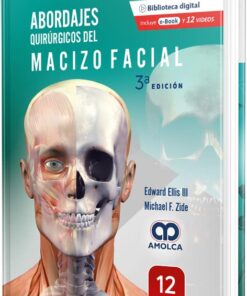 Abordajes Quirúrgicos del Macizo Facial, 3a edición (Scanned PDF)