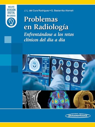 Problemas en Radiología: Enfrentándose a los retos clínicos del día a día (PDF) Problemas en Radiología: Enfrentándose a los retos clínicos del día a día (PDF)