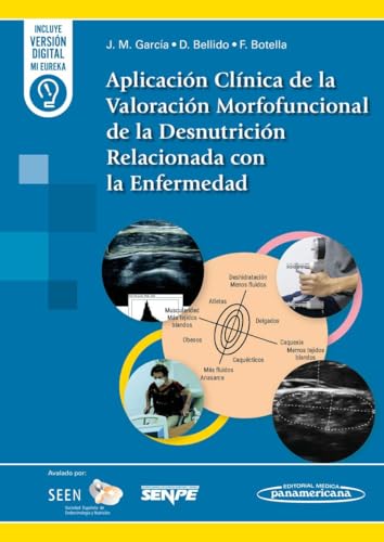 Aplicación Clínica de la Valoración Morfofuncional de la Desnutrición Relacionada con la Enfermedad (PDF) Aplicación Clínica de la Valoración Morfofuncional de la Desnutrición Relacionada con la Enfermedad (PDF)