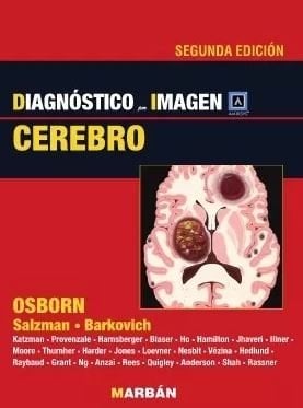 Diagnóstico por Imagen: Cerebro, 2a Edición (Scanned PDF) Diagnóstico por Imagen: Cerebro, 2a Edición (Scanned PDF)