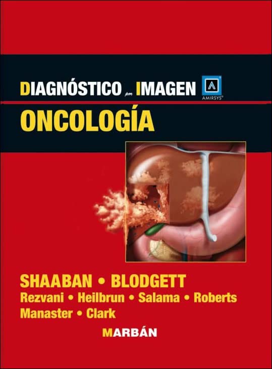 Diagnóstico por imagen. Oncología (Scanned PDF) Diagnóstico por imagen. Oncología (Scanned PDF)