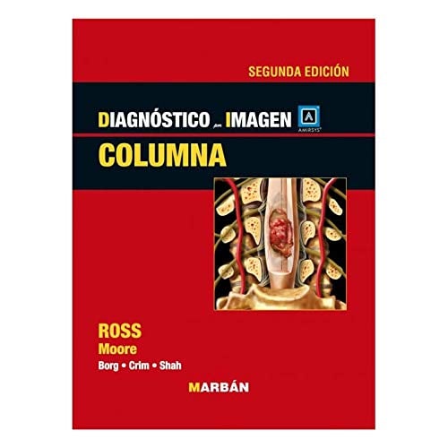 Diagnóstico por Imagen: Columna, 2a Edición (Scanned PDF) Diagnóstico por Imagen: Columna, 2a Edición (Scanned PDF)