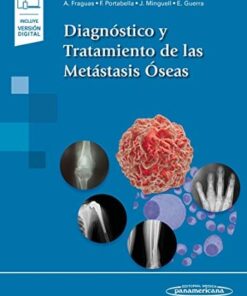 Diagnóstico y Tratamiento de las Metástasis Óseas (PDF)