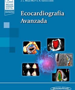 Ecocardiografía Avanzada (Spanish Edition) (PDF)