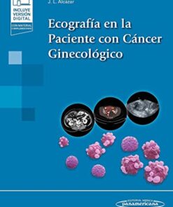 Ecografía en la Paciente con Cáncer Ginecológico (PDF)