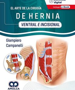 El Arte de la Cirugía de Hernia, Ventral e Incisional (Spanish Edition) (Scanned PDF)