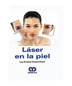 Láser en la piel (Scanned PDF)