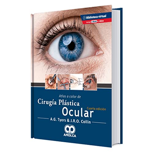 Atlas a color de cirugía plástica ocular, 4a Edición (Scanned PDF) Atlas a color de cirugía plástica ocular, 4a Edición (Scanned PDF)