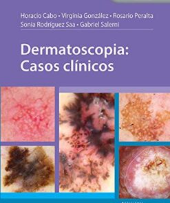 Dermatoscopia: Casos clínicos (Spanish Edition) (Scanned PDF)