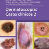 Dermatoscopia: Casos clínicos (Spanish Edition) (Scanned PDF)