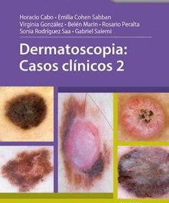 Dermatoscopia: Casos clinicos 2 (Scanned PDF)