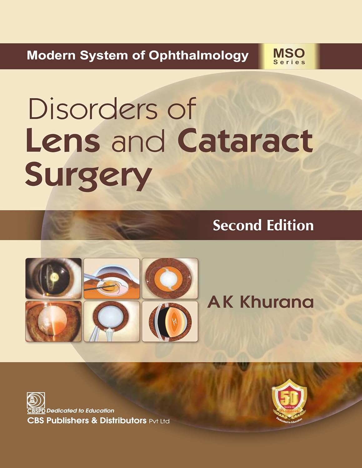 Disorders of Lens and Cataract Surgery (PDF) Disorders of Lens and Cataract Surgery (PDF)