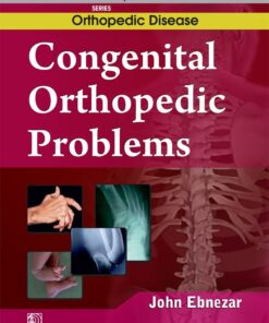 Congenital Orthopedic Problems (EPUB)