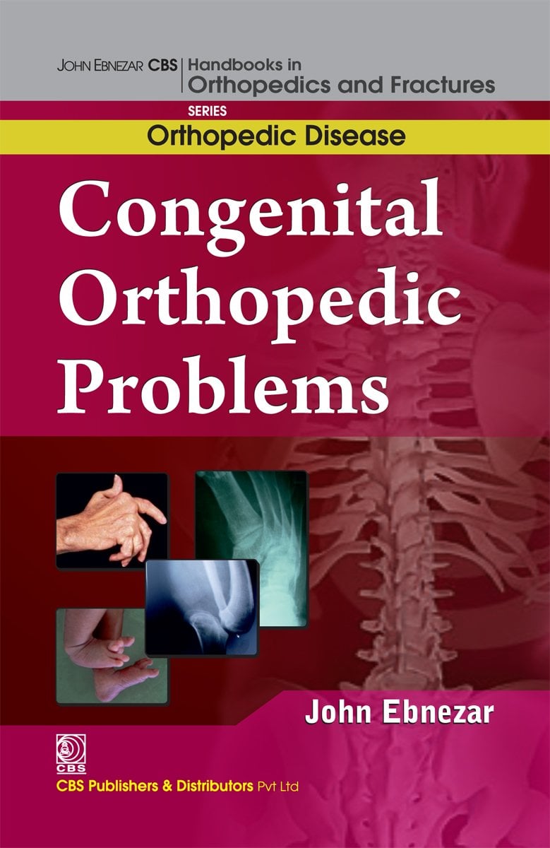 Congenital Orthopedic Problems (EPUB) Congenital Orthopedic Problems (EPUB)