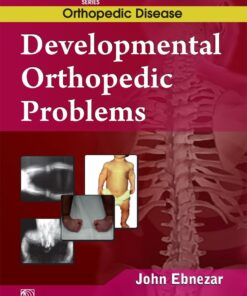 Developmental Orthopedic Problem (EPUB)