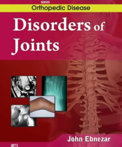 Disorder of Joint (EPUB)