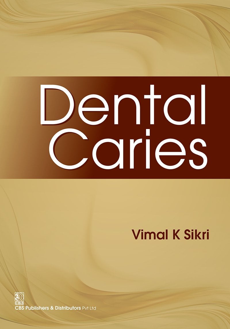 Dental Caries (EPUB) Dental Caries (EPUB)