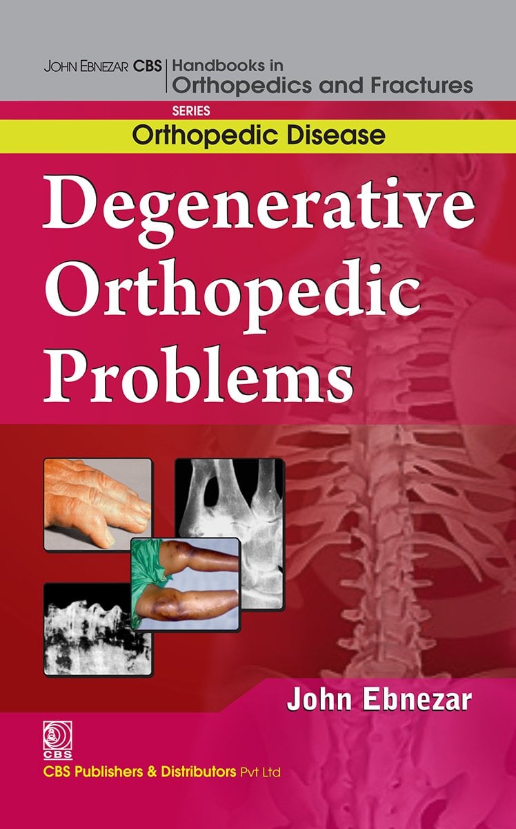 Degenerative Orthopedic Problems (EPUB) Degenerative Orthopedic Problems (EPUB)