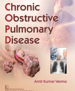COPD Chronic Obstructed Pulmonary Disease (PDF)