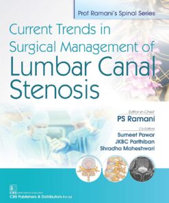 Current Trends in Surgical Management of Lumbar Canal Stenosis (PDF)