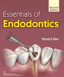 Essentials of Endodontics, 2nd Edition (PDF)