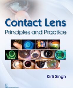 Contact lens Principle and Practice (EPUB)