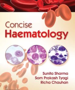 Concise Haematology (EPUB)
