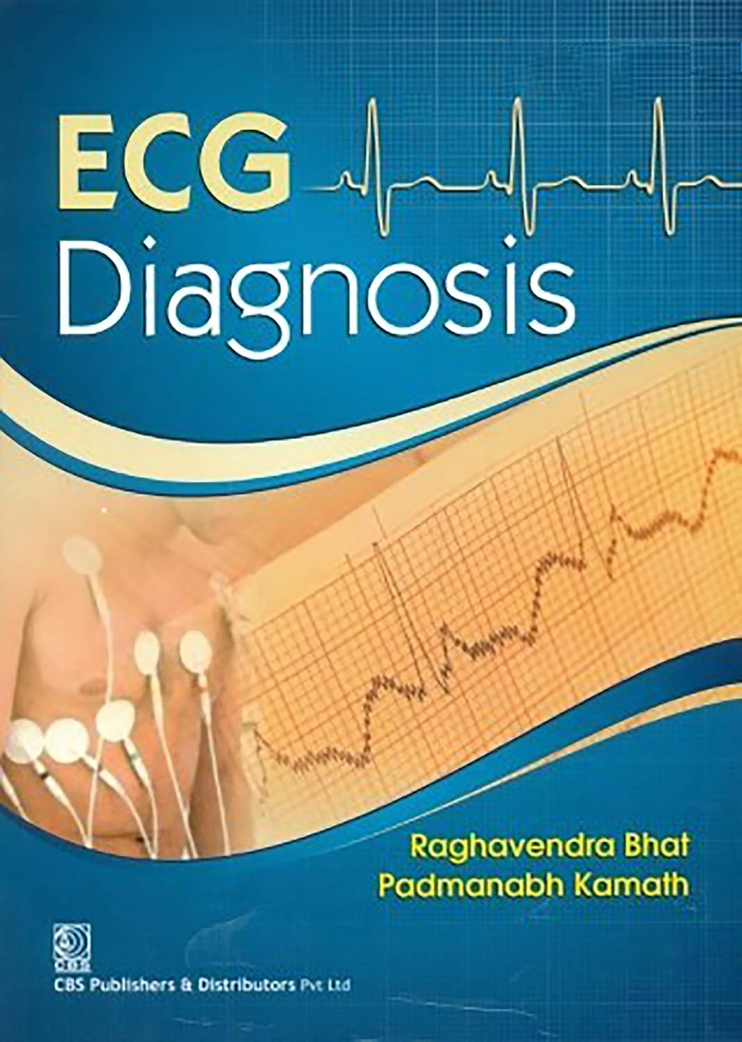 ECG Diagnosis (PDF) ECG Diagnosis (PDF)