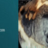 Cleveland Clinic Nephrology Update 2026