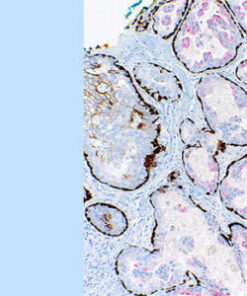 Memorial Sloan Kettering Cancer Center The Pathology of Neoplastic Diseases 2026