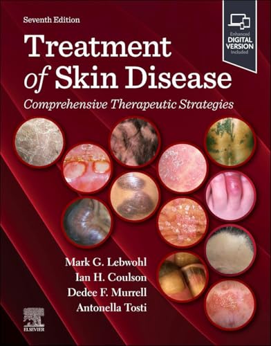 Treatment of Skin Disease: Comprehensive Therapeutic Strategies, 7th edition (True PDF) Treatment of Skin Disease: Comprehensive Therapeutic Strategies, 7th edition (True PDF)