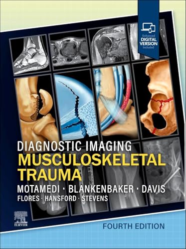 Diagnostic Imaging: Musculoskeletal Trauma, 4th edition (PDF)