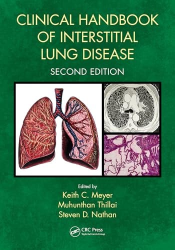 Clinical Handbook of Interstitial Lung Disease, 2nd edition (PDF) Clinical Handbook of Interstitial Lung Disease, 2nd edition (PDF)