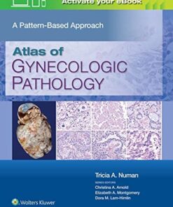 Atlas of Gynecologic Pathology: A Pattern-Based Approach (PDF)