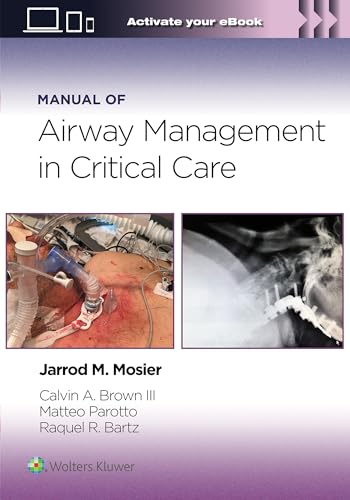Manual of Airway Management in Critical Care (PDF) Manual of Airway Management in Critical Care (PDF)