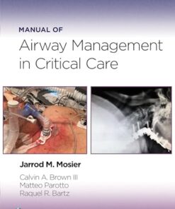 Manual of Airway Management in Critical Care (PDF)