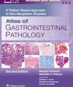 Atlas of Gastrointestinal Pathology: A Pattern-Based Approach to Non-Neoplastic Biopsies, 2nd edition (PDF)