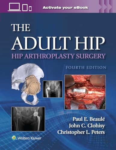 The Adult Hip: Hip Arthroplasty Surgery, 4th Edition (Videos)