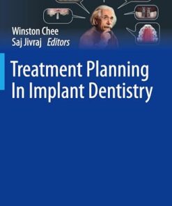 Treatment Planning In Implant Dentistry (BDJ Clinician’s Guides), 2nd edition (PDF)