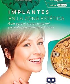 Implantes en la Zona Estética. Guía para el Tratamiento del Paciente Parcialmente Edéntulo (Scanned PDF)