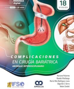 Complicaciones en Cirugía Bariátrica. Abordaje interdisciplinario (Scanned PDF)