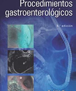 Manual de procedimientos gastroenterológicos, 5a edición (PDF)
